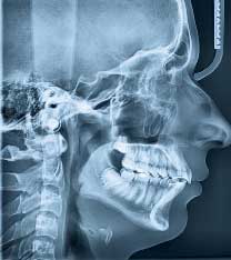 Head jaw X-ray